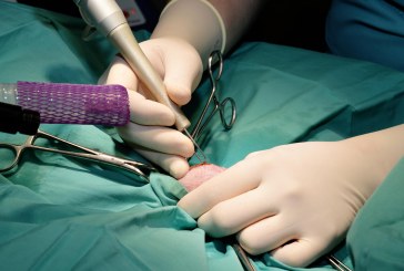 Le déroulement de l’opération dans la chirurgie esthétique