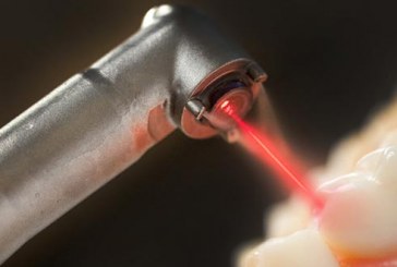 Le laser : technique moderne de la dentisterie